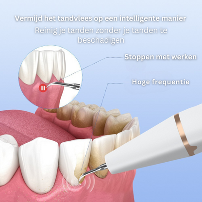 Ultrasone Gebitsreiniger