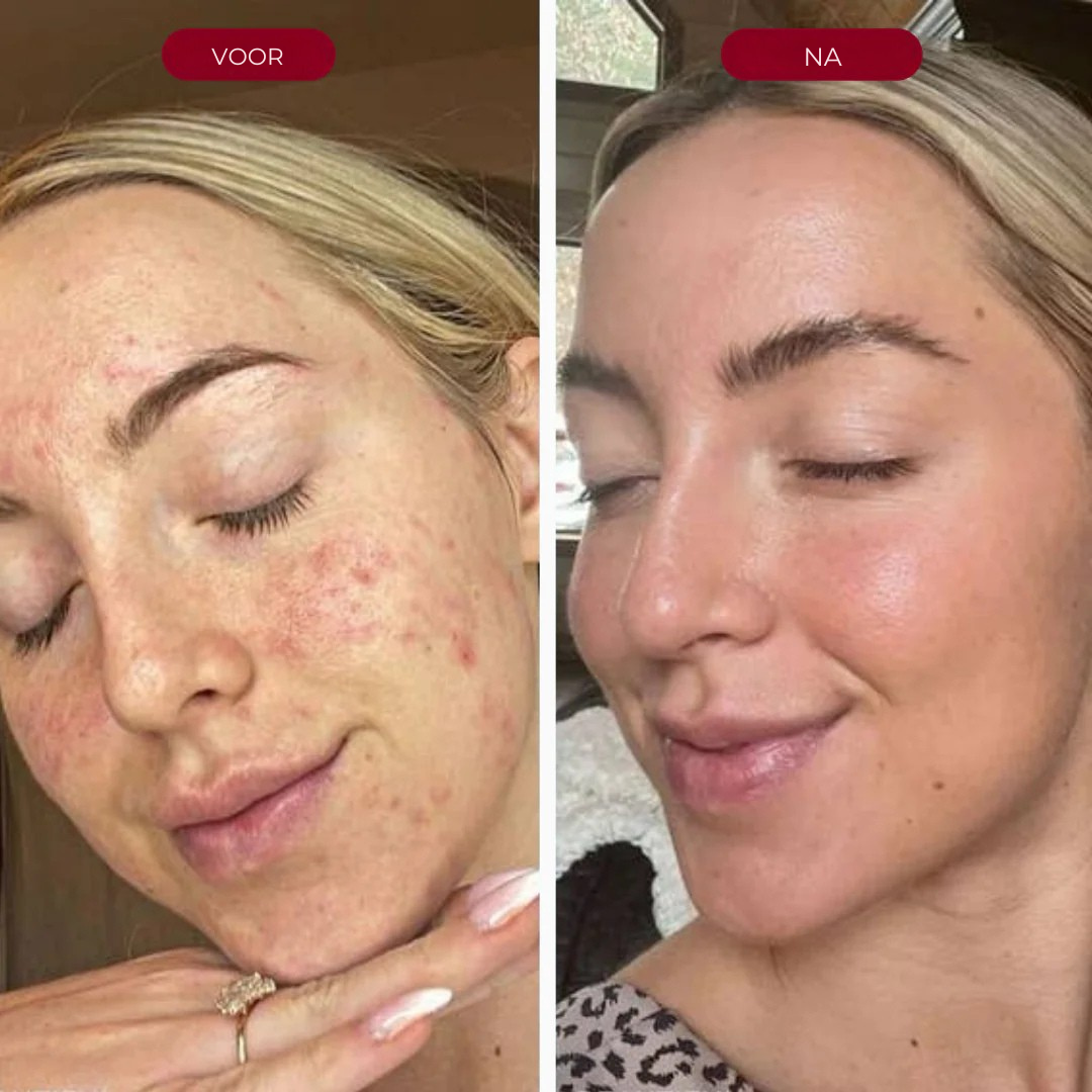 Peel Shot Exfoliant Serum
