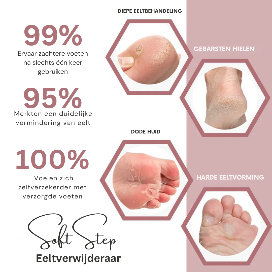 SoftStep Eeltverwijderaar