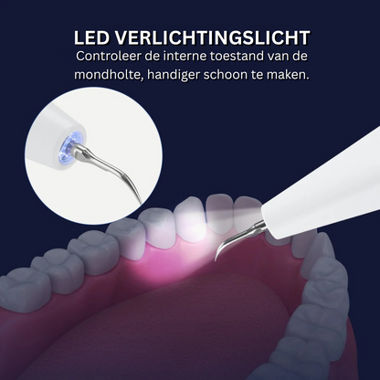 Ultrasone Gebitsreiniger