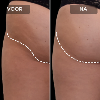 EMS Toning Fitness Short