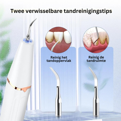 Ultrasone Gebitsreiniger