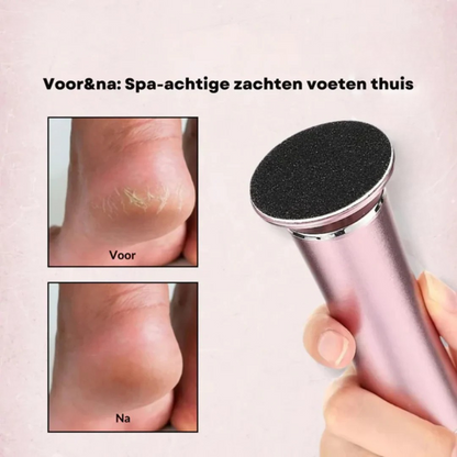 SoftStep Eeltverwijderaar